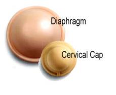 cervical cap